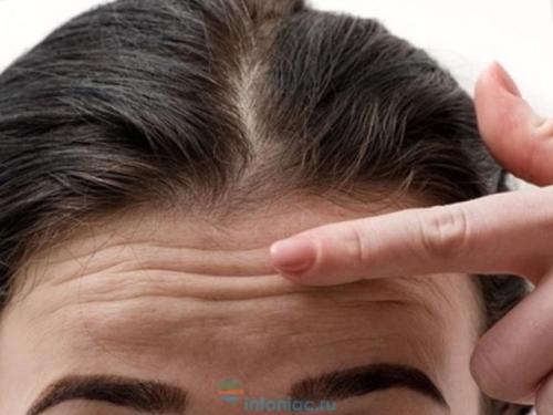 Линия роста волос на лбу у женщин. Какая бывает линия роста