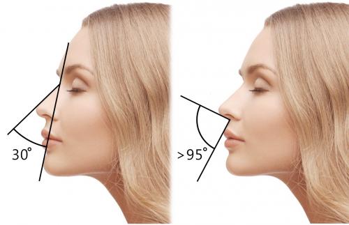 Форма носа у женщин. Идеальный профиль — идеальный нос: