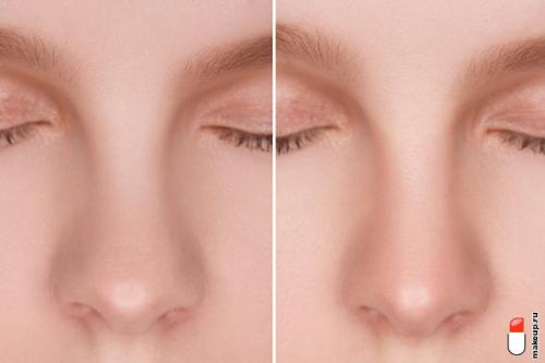 Как нанести макияж на нос, чтобы он выглядел меньше. Контуринг носа: фотоинструкция