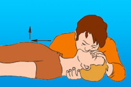 Сердечно-легочная реанимация у взрослых. Техника проведения СЛР: новый стандарт 01