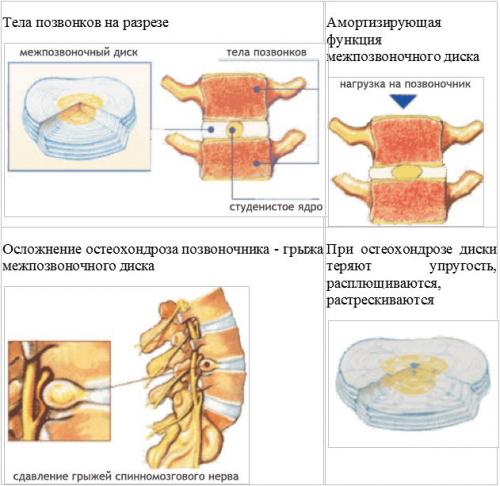 Что нельзя делать при грыже l5-s1. Особенности