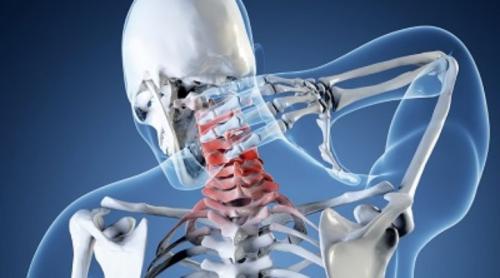 На какой подушке спать при грыже шейного отдела. Грыжа шейного отдела позвоночника