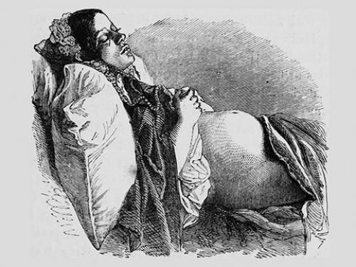 Можно ли спать на правом боку при беременности. Положение тела во время сна не влияет на исход беременности