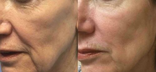 Бьюти-секреты для женщин в зрелом возрасте. В модельный бизнес после 50… 04 Бьюти-секреты для женщин в зрелом возрасте. В модельный бизнес после 50… 04