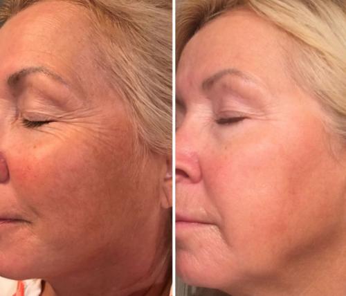 Бьюти-секреты для женщин в зрелом возрасте. В модельный бизнес после 50… 05 Бьюти-секреты для женщин в зрелом возрасте. В модельный бизнес после 50… 05