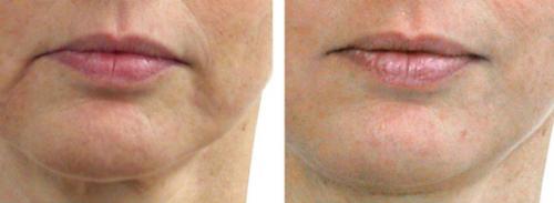 Бьюти-секреты для женщин в зрелом возрасте. В модельный бизнес после 50… 03 Бьюти-секреты для женщин в зрелом возрасте. В модельный бизнес после 50… 03