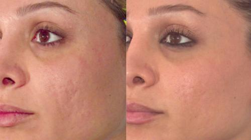 Бьюти-секреты для женщин в зрелом возрасте. В модельный бизнес после 50… 06 Бьюти-секреты для женщин в зрелом возрасте. В модельный бизнес после 50… 06