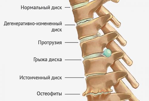 Качественный сон при боли в пояснице. Причины боли 01
