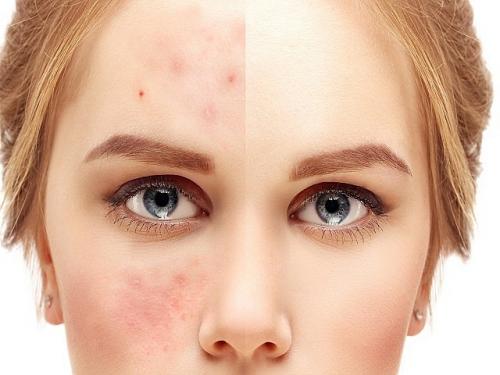 Основы ухода за кожей: советы для разных типов кожи 06