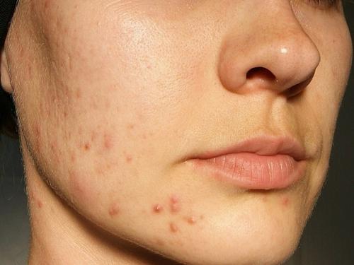 Основы ухода за кожей: советы для разных типов кожи 08