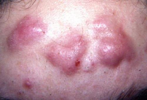 Основы ухода за кожей: советы для разных типов кожи 12