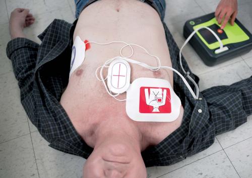 9, что такое пороговое тестирование дефибриллятора? Самостоятельная работа с дефибриллятором: алгоритм 02