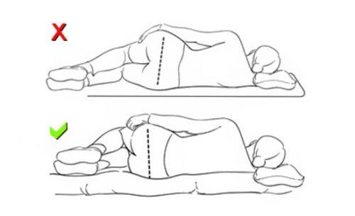 Спать на твердой поверхности при сколиозе. Выбор позы