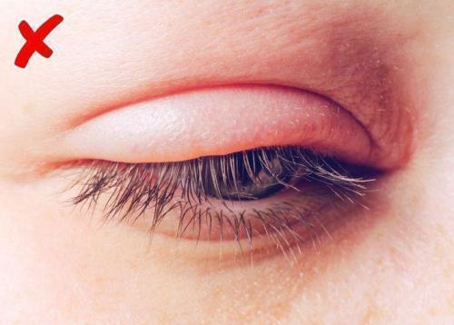 Болезнь внутренних органов по лицу. Зоны проекций - Лицо 09