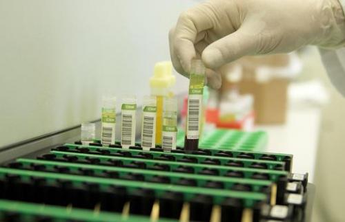 Можно ли заразиться коронавирусом от человека. Даже у тех, кто никогда не был в Китае и не вступал в контакт с заболевшими коронавирусом, может обнаружиться COVID-19. Российские ученые выдвинули две версии распространения нового штамма коронавируса. 03