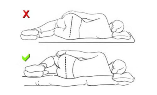 Полезно ли спать на полу при сколиозе. Выбор позы