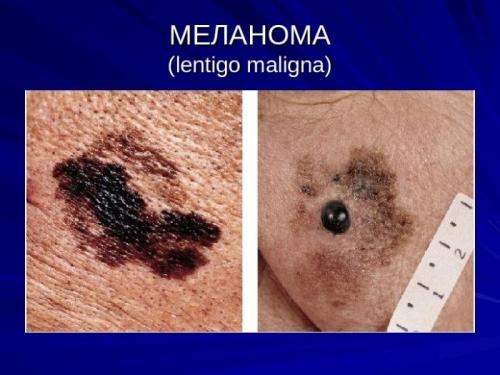 Как болезни отражаются на лице. Виды кожных заболеваний на лице