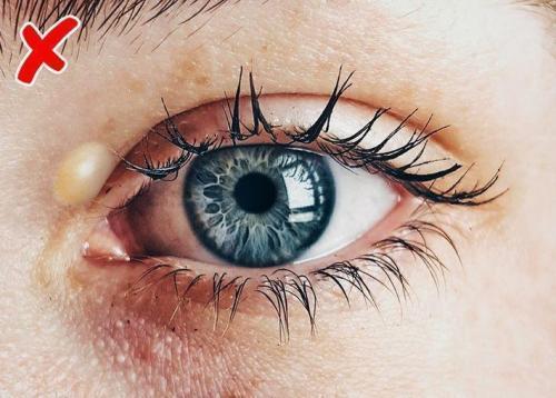 Болезни по лицу. Определение болезней по лицу 06