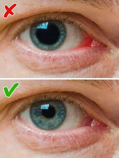 Болезни по лицу. Определение болезней по лицу 03