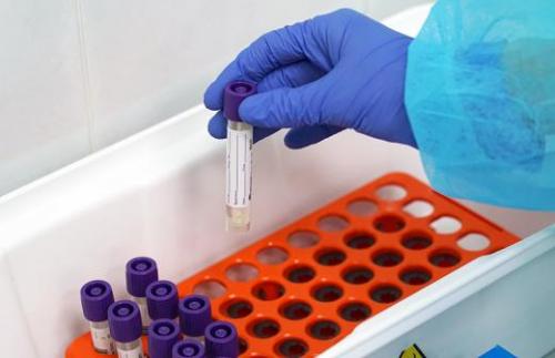 Мишустин утвердил меры по борьбе с коронавирусом в России. Сексуальность зашкаливает: трендовое платье, которое сделает тебя богиней стиля 05