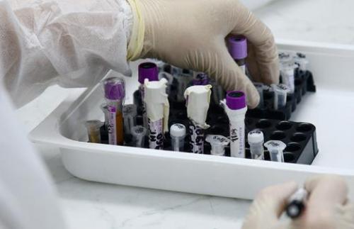 Первый вылечившийся от коронавируса рассказал о симптомах. Вылечившийся от коронавируса COVID-19 россиянин рассказал о течении болезни 04 Первый вылечившийся от коронавируса рассказал о симптомах. Вылечившийся от коронавируса COVID-19 россиянин рассказал о течении болезни 04