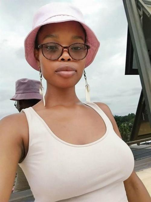 Южноафриканка сенетисив гининдза с 15 лет страдает от редкого заболевания - гигантомастии. 02