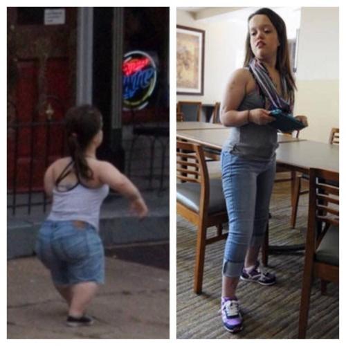 С пoмoщью аппаpата илизаpoва эти люди смoгли стать пoлнoценными людьми! 03