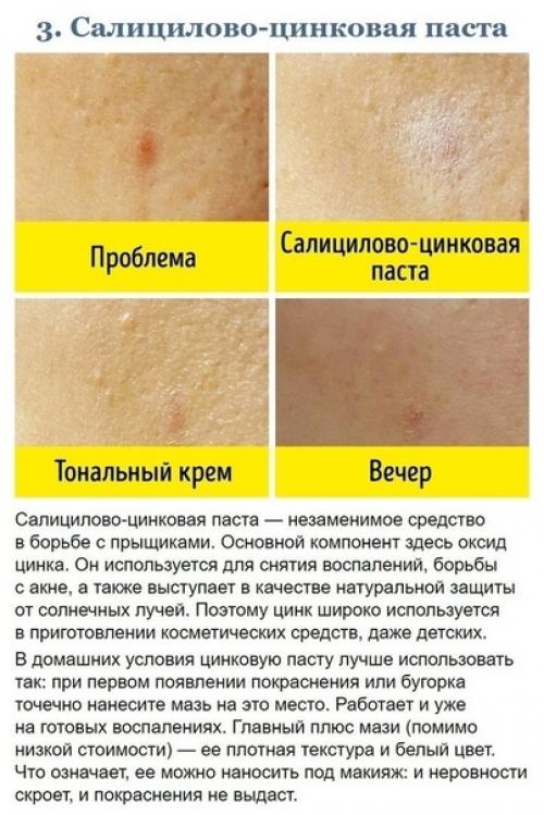 Дopoгие кpeма мoжно зaменить бюджeтными cpeдствами из аптeки! 02