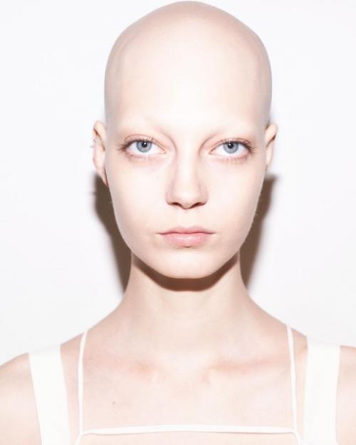Яна Добролюбова - очень красивая модель с алопецией. 01