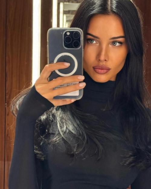 Обидно: Анастасия Решетова утверждает, что не делала пластику. 01