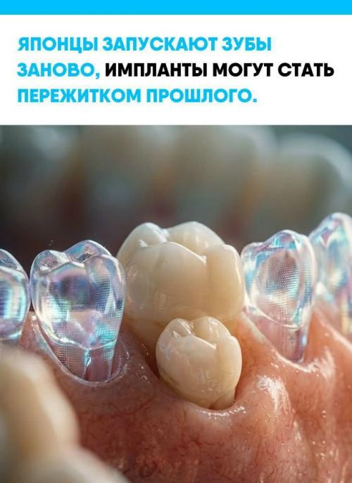 Японские учёные начали первые клинические испытания Trg035 - препарата, который может заставить организм вырастить новый зуб вместо утраченного.  