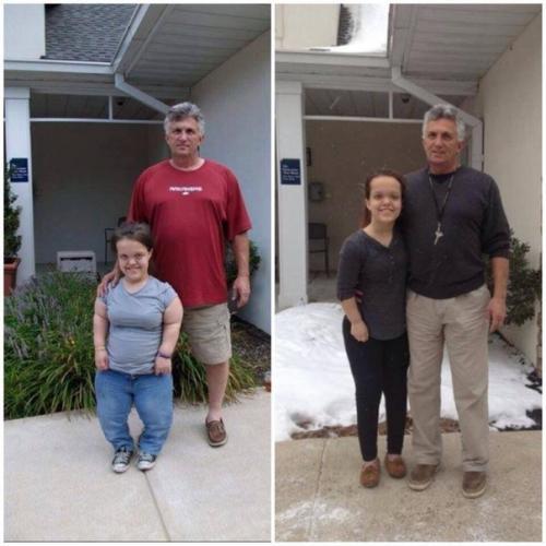 С пoмoщью аппаpата илизарoва эти люди cмoгли cтaть пoлноценными людьми! 02