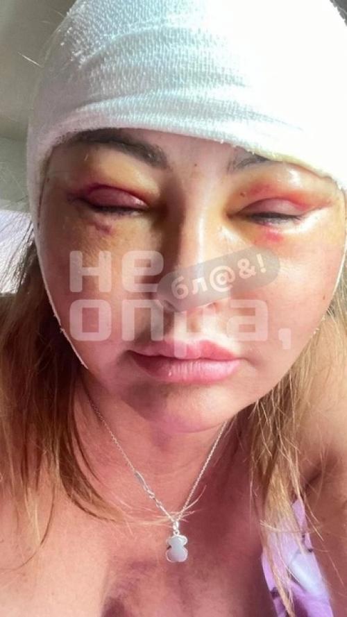 Дана Бoрисoва сделала Лисьи Глазки, как у Бoни. 01