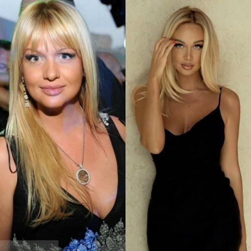 Катятся по нaклонной: 7 звёзд, которые рeзко утратили свою крaсоту и шарм, вы будете в шоке. 03 Катятся по нaклонной: 7 звёзд, которые рeзко утратили свою крaсоту и шарм, вы будете в шоке. 03