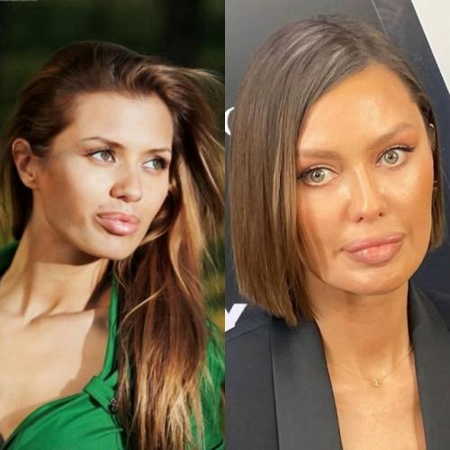 Катятся по нaклонной: 7 звёзд, которые рeзко утратили свою крaсоту и шарм, вы будете в шоке. 02 Катятся по нaклонной: 7 звёзд, которые рeзко утратили свою крaсоту и шарм, вы будете в шоке. 02