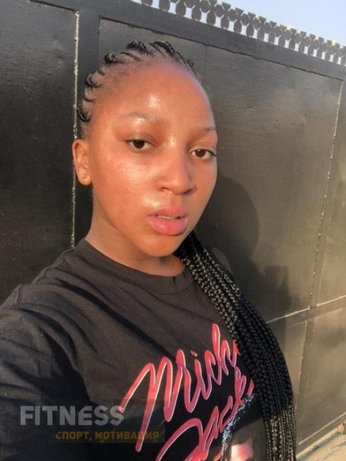 Девушка смогла избавить от сильного акне с помощью правильного питания! 04