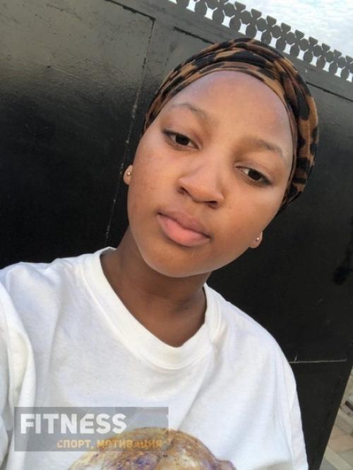 Девушка смогла избавить от сильного акне с помощью правильного питания! 05