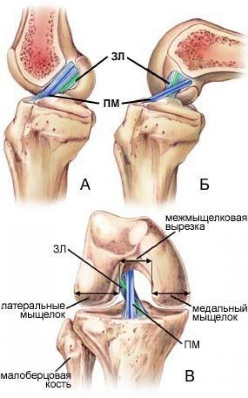 В суставе мыщелок. Крестообразные связки коленного сустава анатомия. Передняя крестообразная связка коленного сустава строение. Крестовидные связки коленного сустава анатомия. Коленный сустав строение мыщелок.