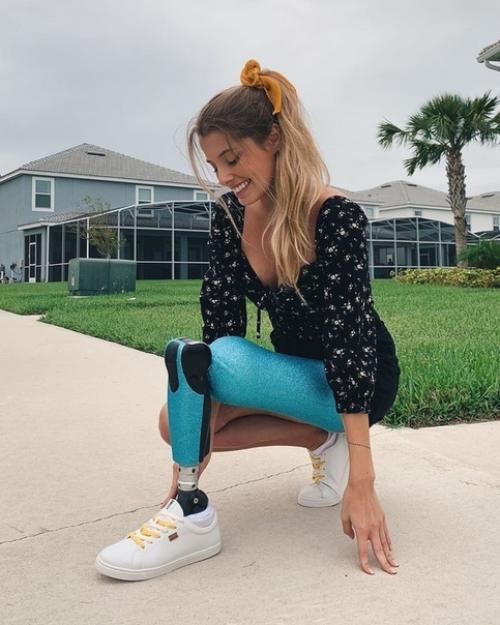 22-Летняя мoдeль аoла антонини, которaя мoтивируeт тыcячи людей! 04