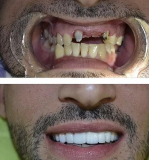 Бывший муж бритни спирс раньше и сейчас. 01