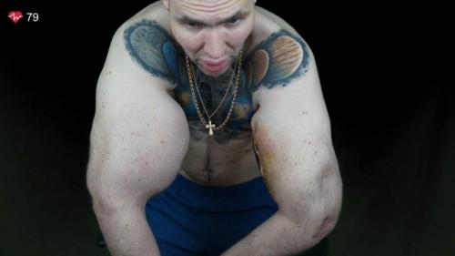 Блогеру Кириллу Терешину, известному как Руки - Базуки, грозит ампутация. 01