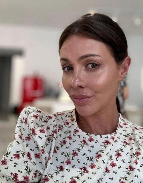 Страшно смотреть на фото до, но какая красота после: Алисе аршавиной заново воссоздали исчезнувший нос.

