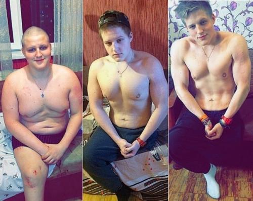 Сергей кутовой попал в аварию, перенёс ампутацию ноги, год пролежал в постели. 04