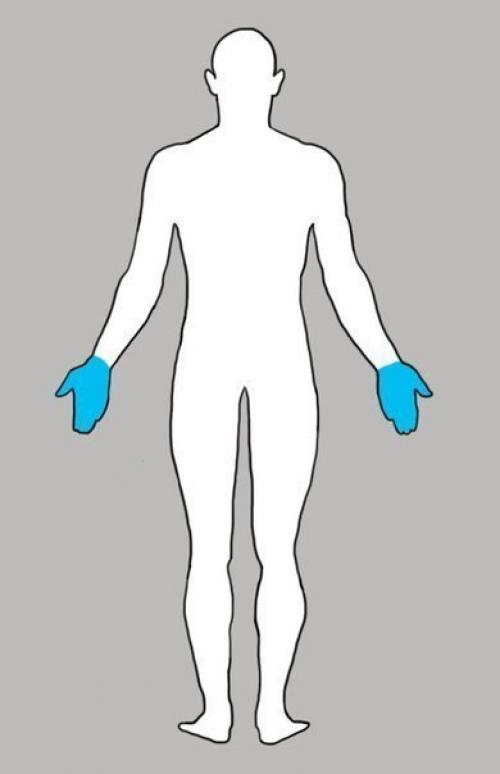 iПочему У нас вечно что-то болит: всему есть своя причина? 06 iПочему У нас вечно что-то болит: всему есть своя причина? 06