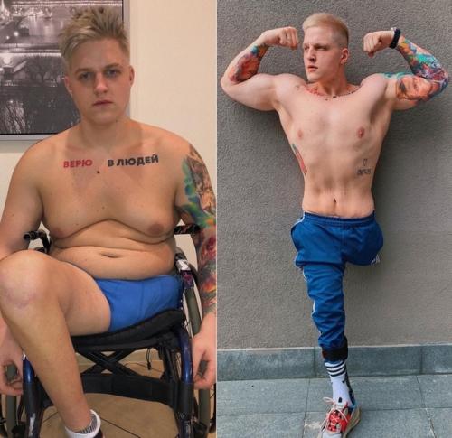 Сергей кутовой попал в аварию, перенёс ампутацию ноги, год пролежал в постели. 02