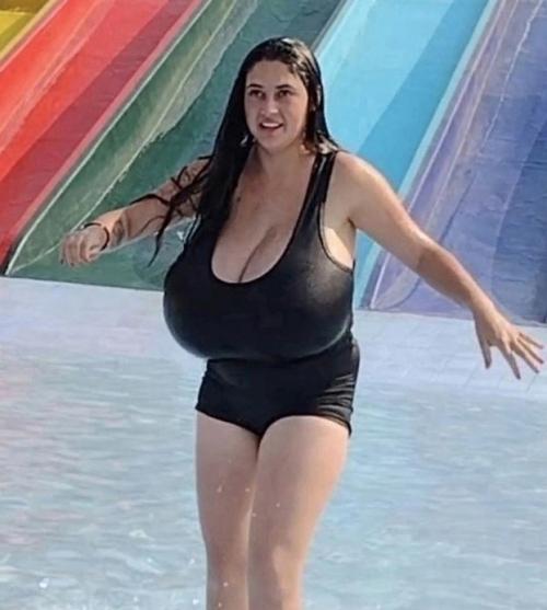 Молодая бразильянка, которой всего 22 года, долгое время страдала от редкого заболевания, известного как Гигантомастия. 01