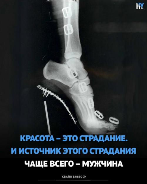 Красота - это боль.  