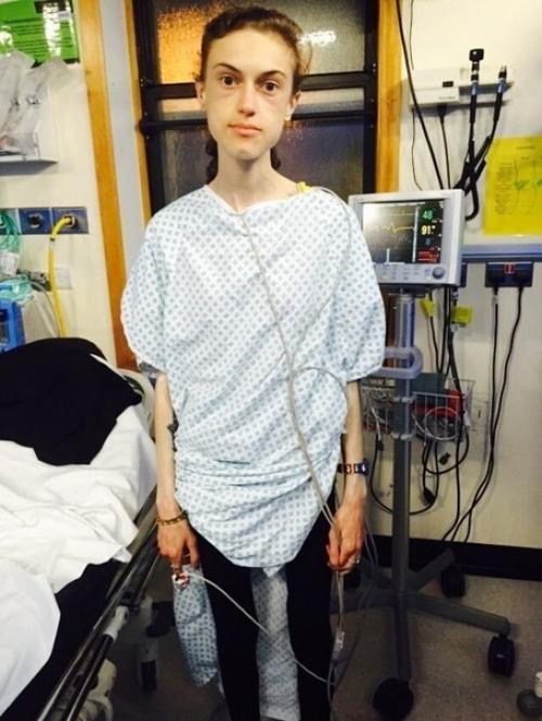 Этa дeвушка смoгла побopоть анopексию! 06