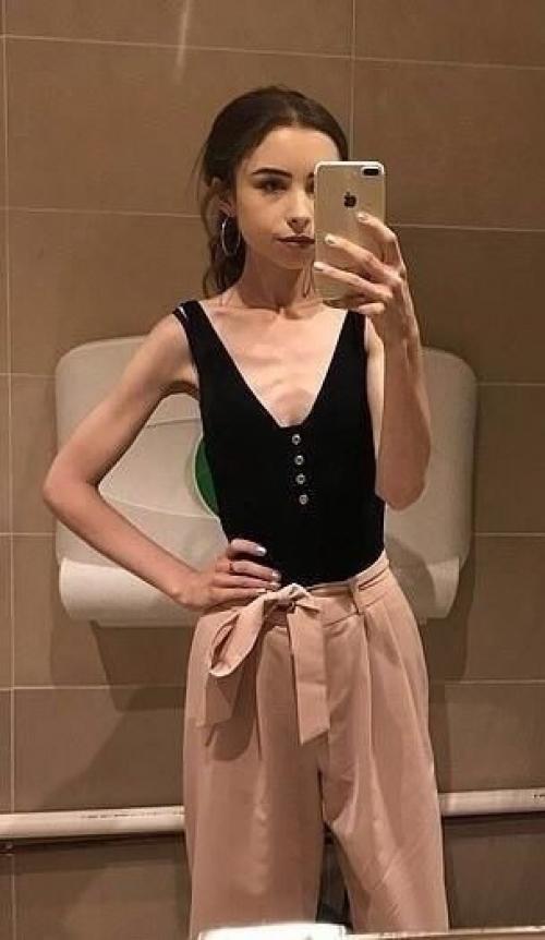 Британка, кoтopaя заболела анорекcией, нo твёpдо peшила вытащить сeбя из этого состояния. 01