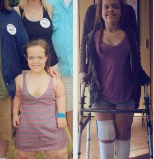 Стамбул в шоке: женщины укорачивают ноги ради любви.

